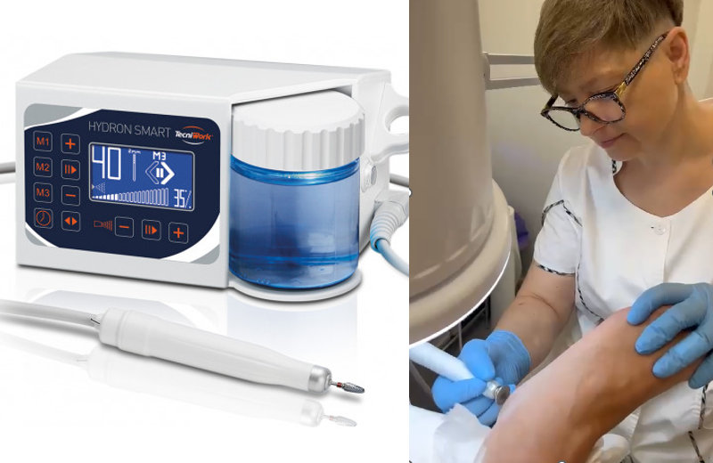 dry pedicure con frese per calli, occhi di pernice, unghie incarnite